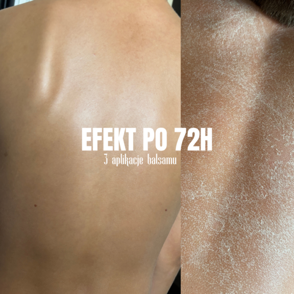 skóra nawilżona, odżywiona i zregenerowana po balsamie